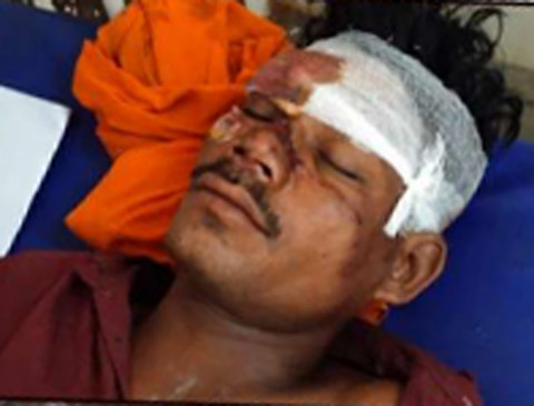 13 injured as a vehicle carrying laborers overturns 13 injured as a vehicle carrying laborers overturns