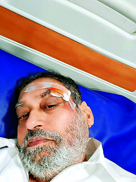 Nitin Raut got injured during the journey Nitin Raut got injured during the journey