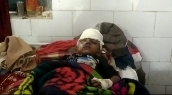 Bike became uncontrolled due to child stumbling, four injured