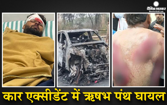 झपकी आने से डिवाइडर से टकराई कार और लग गई आग, खुद स्क्रीन तोड़कर बाहर निकले पंत, शरीर पर कई जगह गंभीर चोट आईं