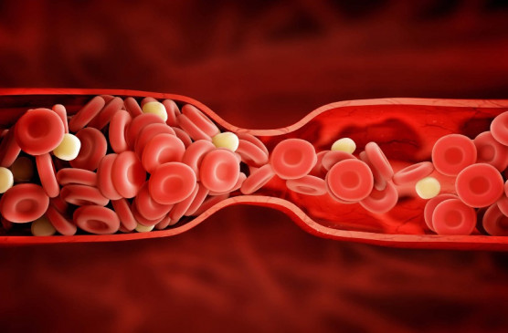 Now sickle cell has spread its wings, got 2,632 patients in a year