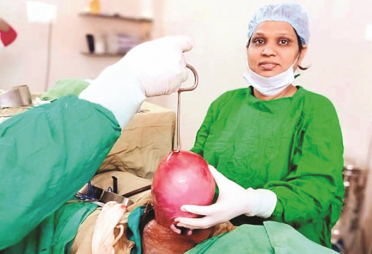 4 kg shell removed from womans stomach