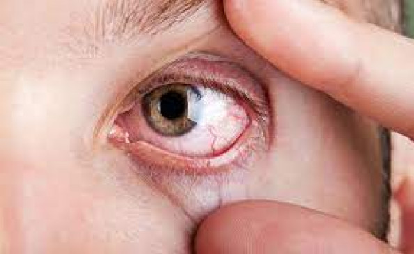 About 500 eye donations are made every year, only 200 are used. About 500 eye donations are made every year, only 200 are used.