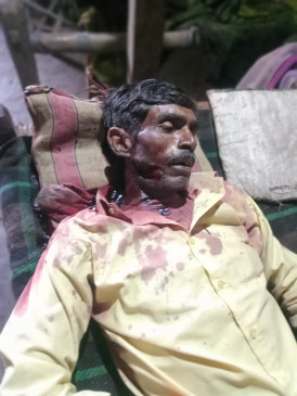 minor son killed his father by hitting him with an ax